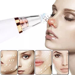 SUCCIONADOR DE POROS